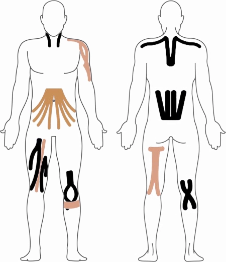 Univerzálna aplikácia na celé telo