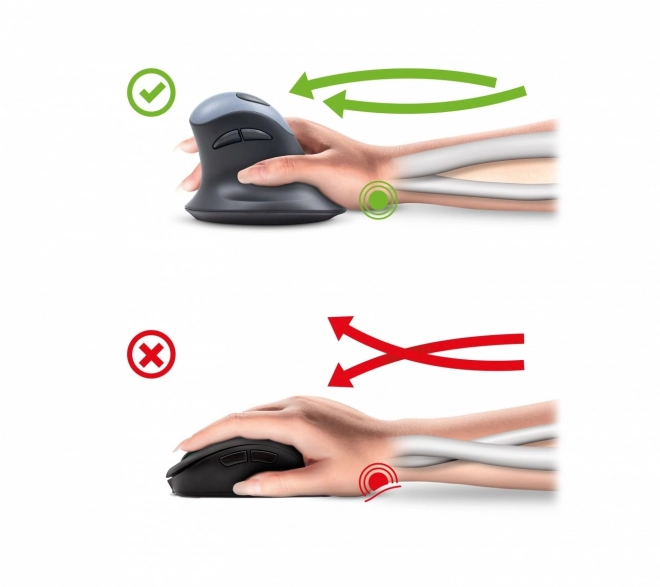 Ergonomická vertikálna myš ERGO
